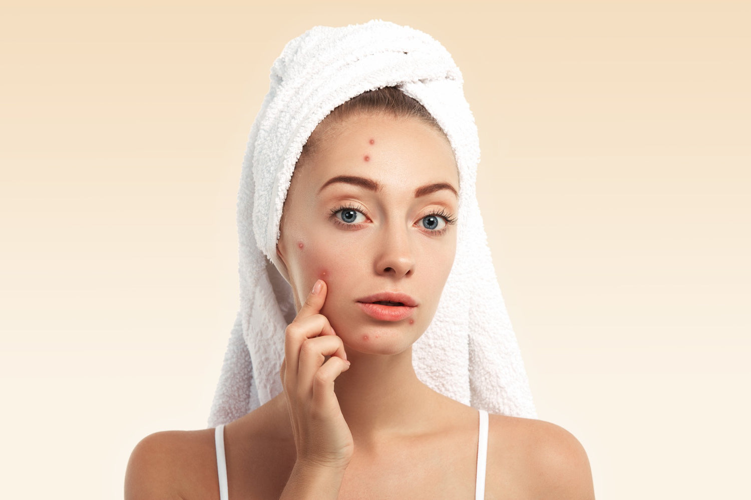Anti-acne