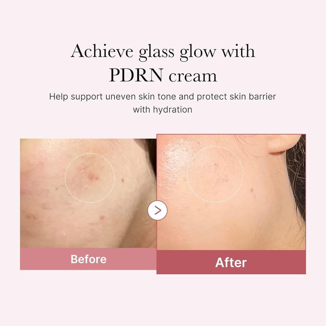 (3 Units) PDRN Pink Hyaluronic Moisturizing Cream Bundle